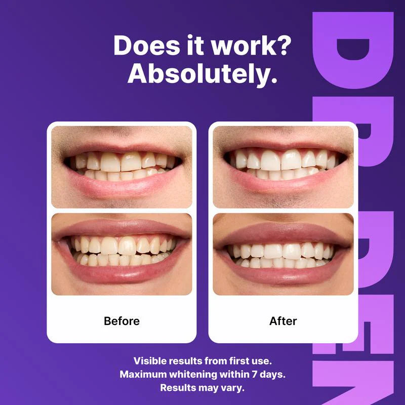 Dental Whitening Strips Enamel Care
