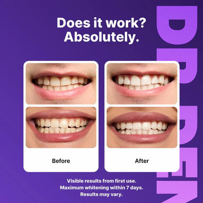 Dental Whitening Strips Enamel Care